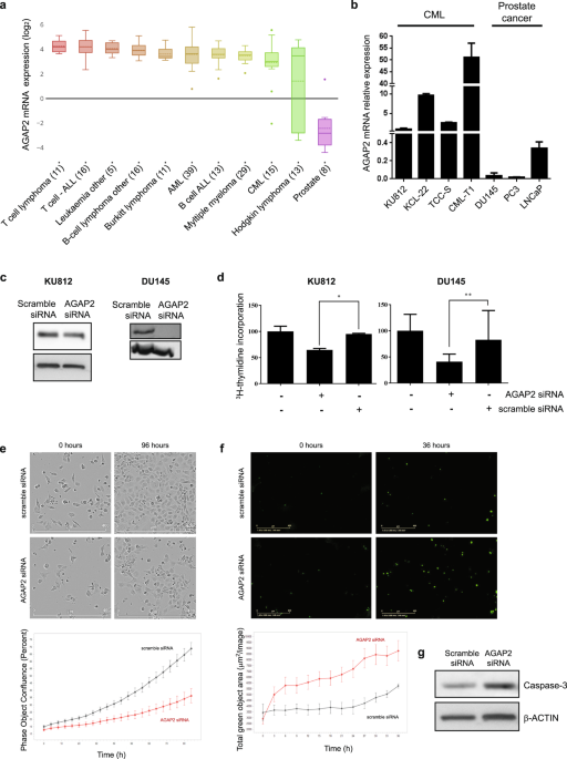 QnA VBage SP1 and RARα regulate AGAP2 expression in cancer