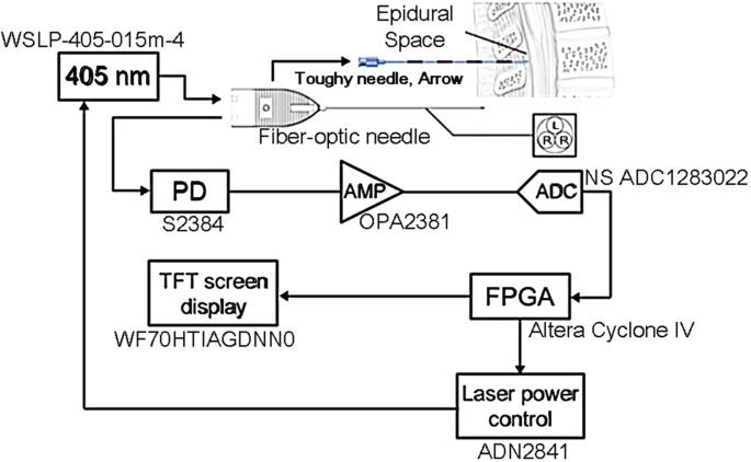 Optically Guided Epidural Needle Placement Using 405 Nm Wavelength For Accurate Puncture Scientific Reports
