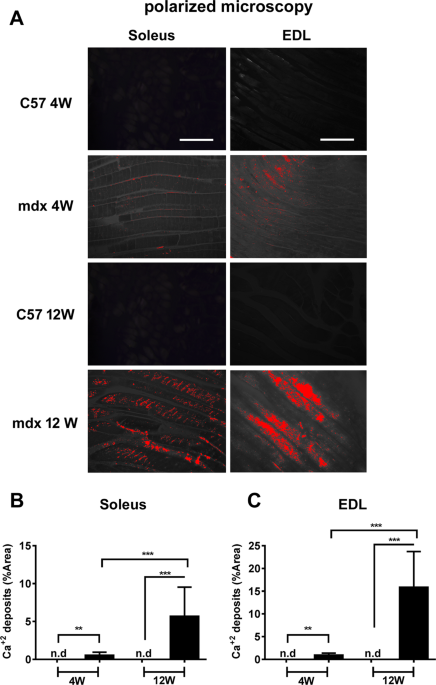 Reduced mitochondrial respiration and increased calcium deposits in the EDL  muscle, but not in soleus, from 12-week-old dystrophic mdx mice |  Scientific Reports