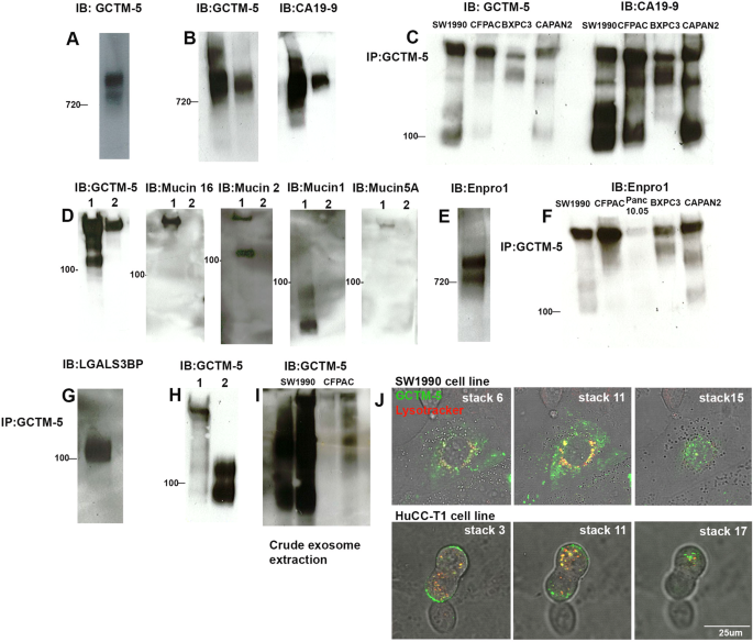 Antibodies to a CA 19-9 Related Antigen Complex Identify SOX9 Expressing  Progenitor Cells In Human Foetal Pancreas and Pancreatic Adenocarcinoma |  Scientific Reports