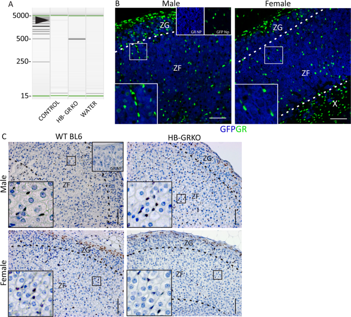Ablation Of Glucocorticoid Receptor In The Hindbrain Of The Mouse Provides A Novel Model To Investigate Stress Disorders Scientific Reports
