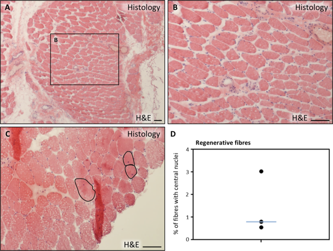 Isolation And Characterization Of Myogenic Precursor Cells From Human Cremaster Muscle Scientific Reports