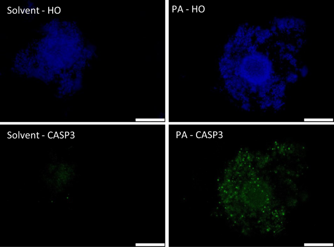 Proteomic Changes In Oocytes After In Vitro Maturation In Lipotoxic Conditions Are Different From Those In Cumulus Cells Scientific Reports Proteomic Changes In Oocytes After In Vitro Maturation In Lipotoxic Conditions Are Different From Those In Cumulus Cells Scientific Reports