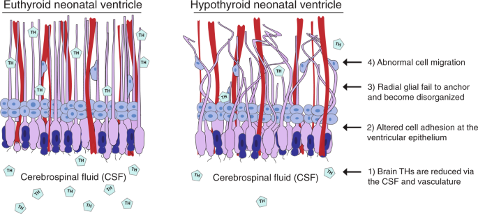 A transient window of hypothyroidism alters neural progenitor cells and ...