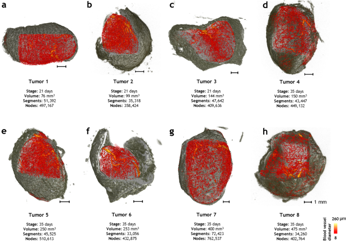 Tumor Ensemble Based Modeling And Visualization Of Emergent Angiogenic Heterogeneity In Breast Cancer Scientific Reports