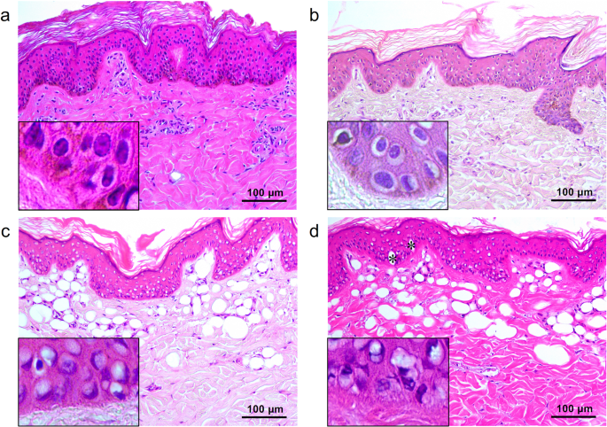 Pattern analysis of 532- and 1,064-nm picosecond-domain laser-induced  immediate tissue reactions in ex vivo pigmented micropig skin | Scientific  Reports