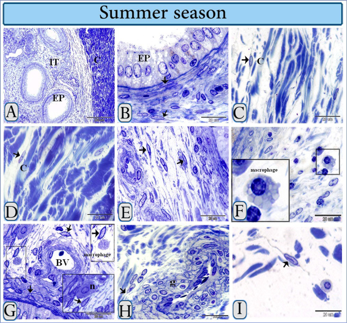 Morphological changes of telocytes in camel efferent ductules in response  to seasonal variations during the reproductive cycle | Scientific Reports