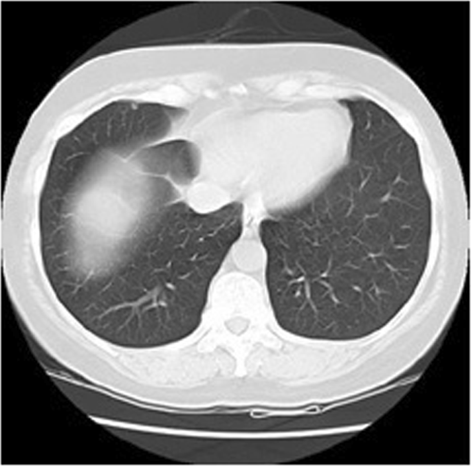 Effective and Reliable Framework for Lung Nodules Detection from CT Scan  Images | Scientific Reports