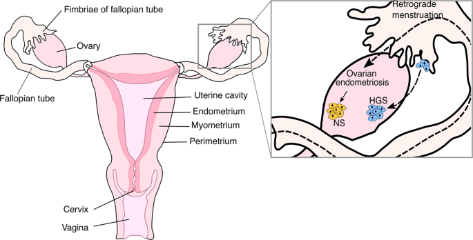 Ovarian cancer cell lines derived from non-serous carcinomas migrate and  invade more aggressively than those derived from high-grade serous  carcinomas | Scientific Reports