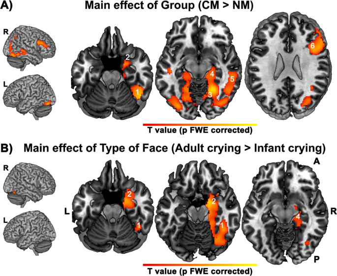 What happens to your brain when a baby cries?