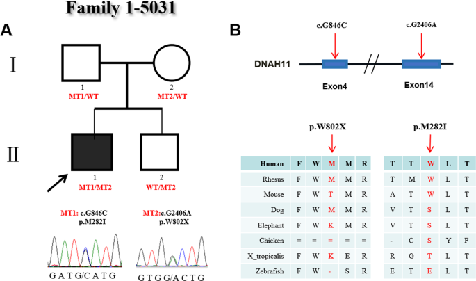 Dnah11 variants and its association with congenital heart disease and heterotaxy syndrome