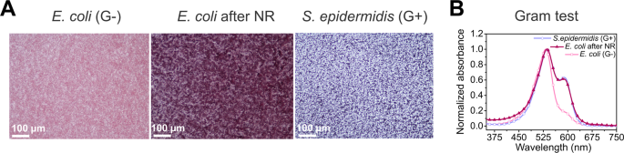 Phenotypic Plasticity Of Escherichia Coli Upon Exposure To Physical Stress Induced By Zno Nanorods Scientific Reports Phenotypic Plasticity Of Escherichia Coli Upon Exposure To Physical Stress Induced By Zno Nanorods Scientific Reports