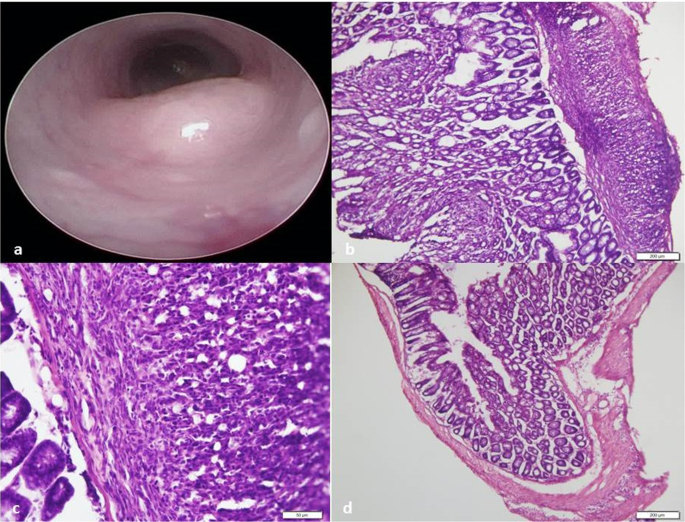 Size and lipid modification determine liposomal Indocyanine green performance for tumor imaging in a