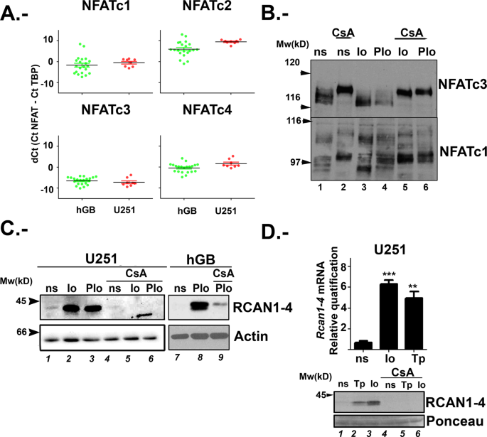 Nfatc3 Controls Tumour Growth By Regulating Proliferation And Migration Of Human Astroglioma Cells Scientific Reports