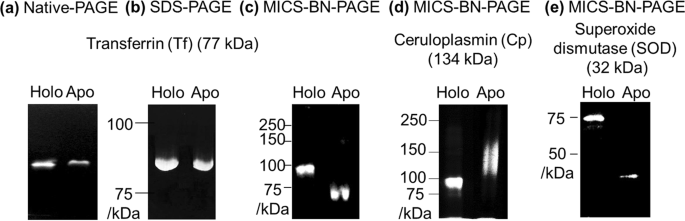 Two-Dimensional Polyacrylamide Gel Electrophoresis for Metalloprotein  Analysis Based on Differential Chemical Structure Recognition by CBB Dye |  Scientific Reports