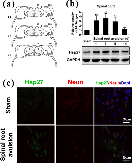 Up-regulation of heat shock protein 27 inhibits apoptosis in lumbosacral  nerve root avulsion-induced neurons | Scientific Reports