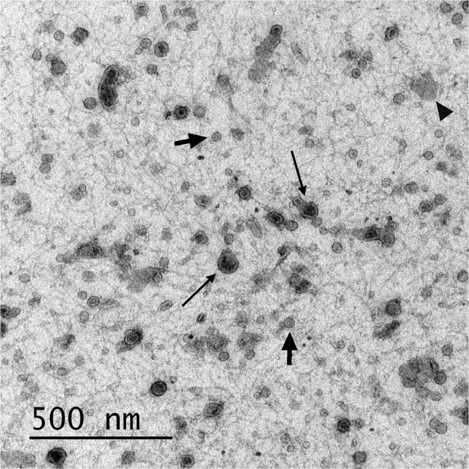 Extracellular vesicles isolated from porcine seminal plasma exhibit  different tetraspanin expression profiles | Scientific Reports