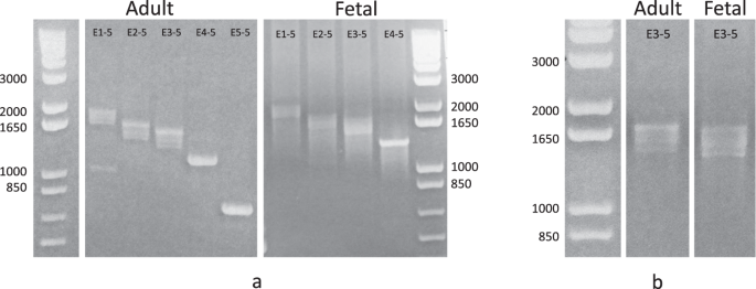 A Vntr Regulates Mir 137 Expression Through Novel - 