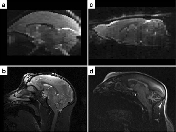 Frontiers  Automated Skull Stripping in Mouse Functional Magnetic  Resonance Imaging Analysis Using 3D U-Net