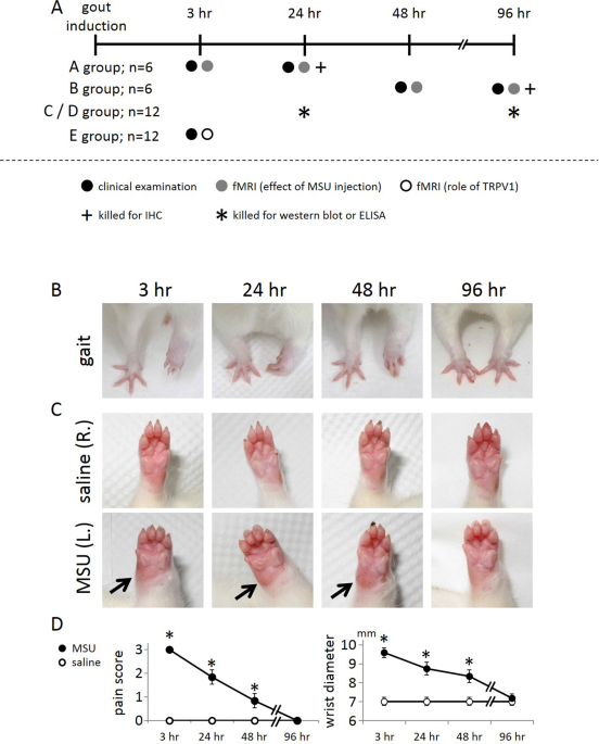 Fmri indicates cortical activation through trpv1 modulation during acute gouty attacks