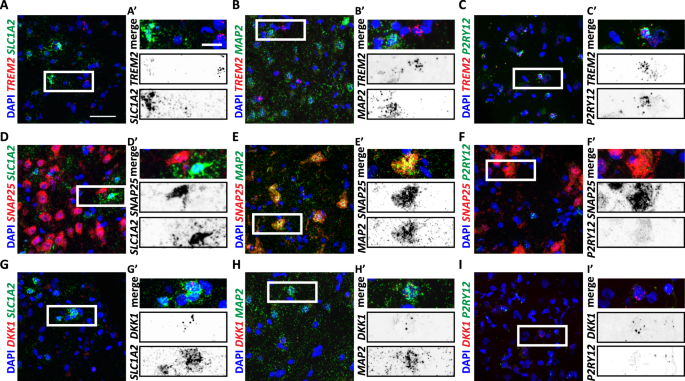 2023 Mar 28 - Getting Started with RNAscope™ Image Analysis in HALO®, In  Situ Hybridization, RNA-ISH