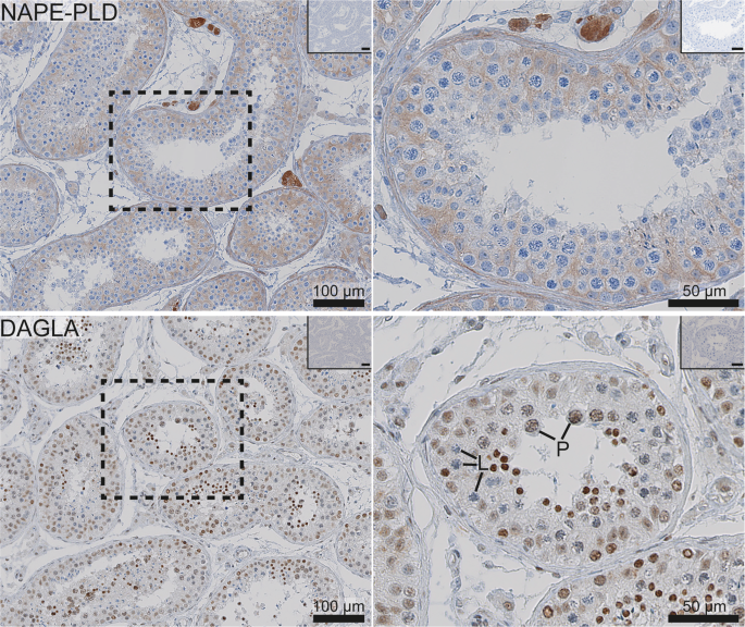 Characterisation and localisation of the endocannabinoid system components  in the adult human testis