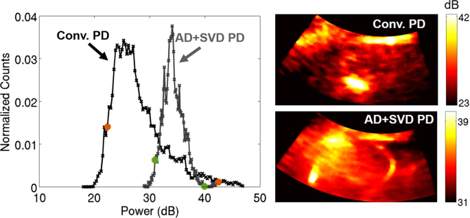 Non-contrast power Doppler ultrasound imaging for early assessment