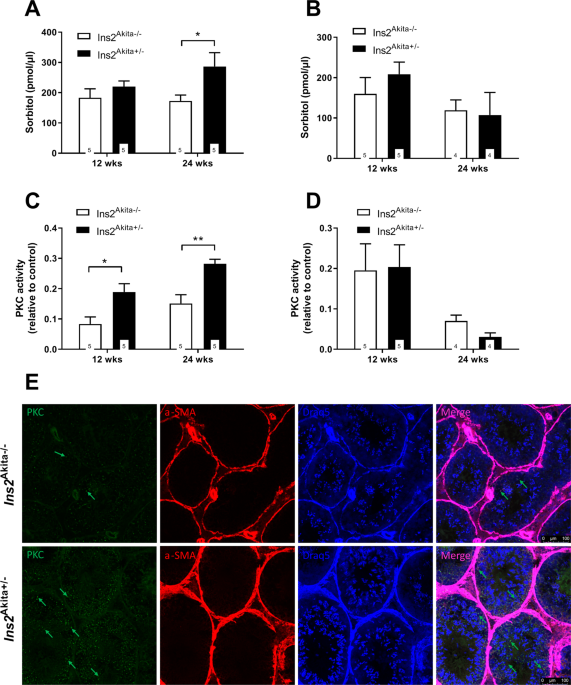 Hyperglycemia induces spermatogenic disruption via major pathways of diabetes pathogenesis