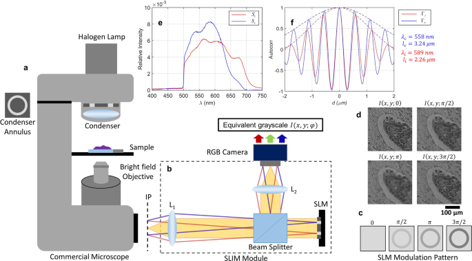Now Dot celestial Quantitative Histopathology of Stained Tissues using Color Spatial Light Interference Microscopy (cSLIM) | Scientific Reports Now Dot celestial Quantitative Histopathology of Stained Tissues using Color Spatial Light Interference Microscopy (cSLIM) | Scientific Reports