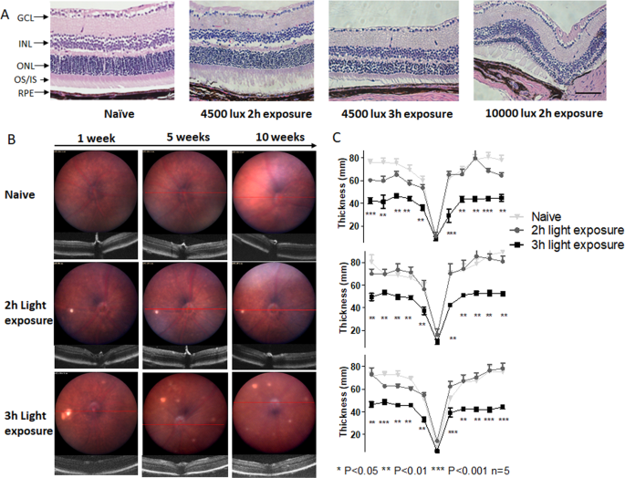 Light-induced Nrf2−/− mice as atrophic age-related macular degeneration  model and treatment with nanoceria laden injectable hydrogel | Scientific  Reports