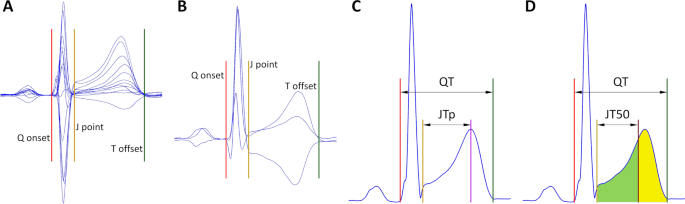 Heart Rate Correction Of The J To Tpeak Interval Scientific Reports