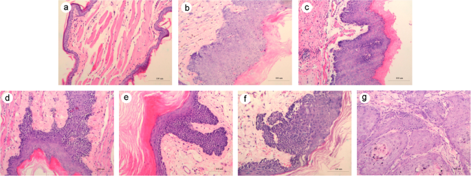 Identification And Profiling Of Micrornas Expressed In Oral Buccal Mucosa Squamous Cell Carcinoma Of Chinese Hamster Scientific Reports Identification And Profiling Of Micrornas Expressed In Oral Buccal Mucosa Squamous Cell Carcinoma Of Chinese Hamster Scientific Reports