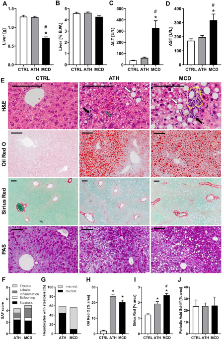 Multi Technique Comparison Of Atherogenic And Mcd Nash Models Highlights Changes In Sphingolipid Metabolism Scientific Reports Multi Technique Comparison Of Atherogenic And Mcd Nash Models Highlights Changes In Sphingolipid Metabolism Scientific Reports