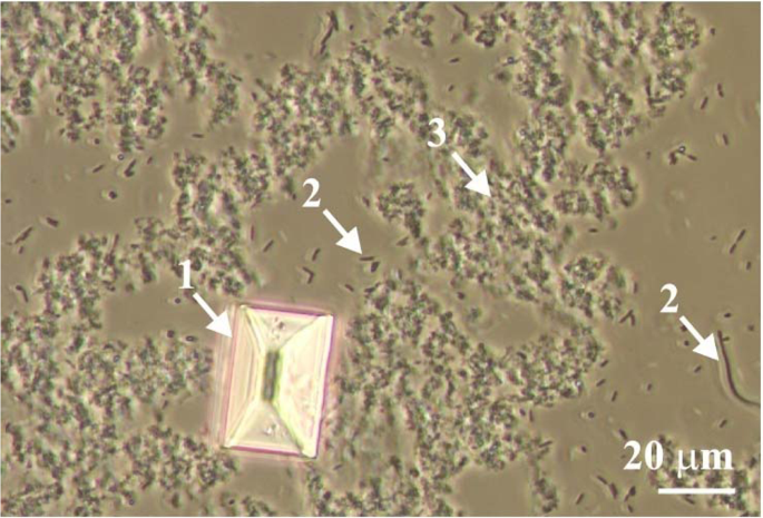 amorphous urates in urine