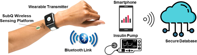 A Novel Needle-Injectable Millimeter scale Wireless Electrochemical Glucose  Sensing Platform for Artificial Pancreas Applications | Scientific Reports