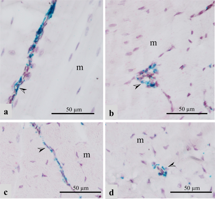 Dysregulation Of Lipid Metabolism And Appearance Of Slow Myofiber Specific Isoforms Accompany The Development Of Wooden Breast Myopathy In Modern Broiler Chickens Scientific Reports Dysregulation Of Lipid Metabolism And Appearance Of Slow Myofiber Specific Isoforms Accompany The Development Of Wooden Breast Myopathy In Modern Broiler Chickens Scientific Reports