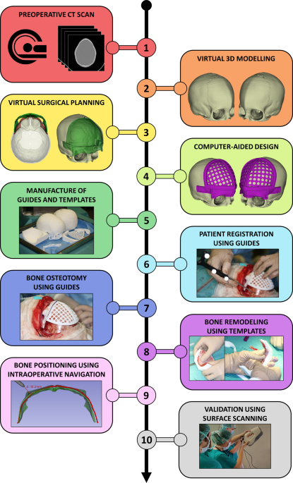 Craniosynostosis Surgery Workflow Based On Virtual Surgical Planning Intraoperative Navigation And 3d Printed Patient Specific Guides And Templates Scientific Reports