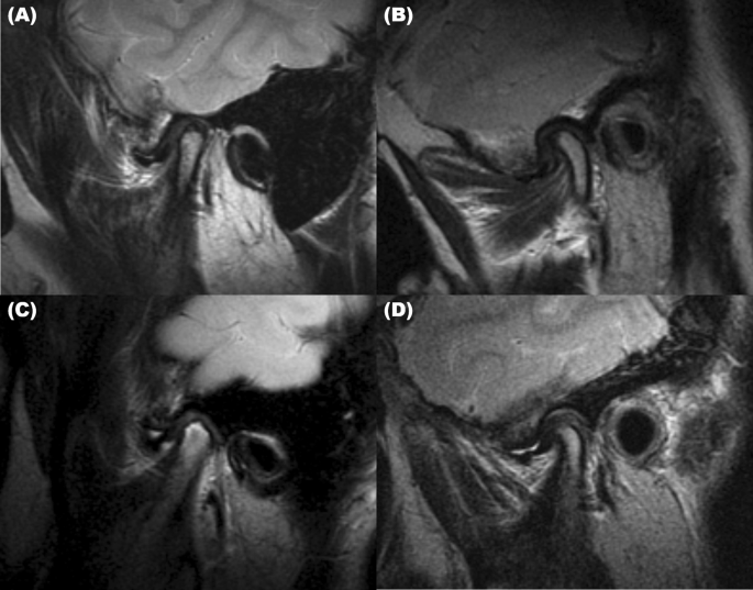 Psychological Factors that Influence Decision-Making Regarding Trauma-Related Pain in Adolescents with Temporomandibular Disorder Scientific Reports