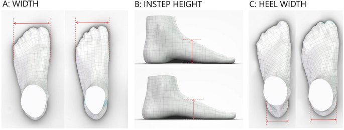 3D scan reveals how high heels can leave your feet disfigured