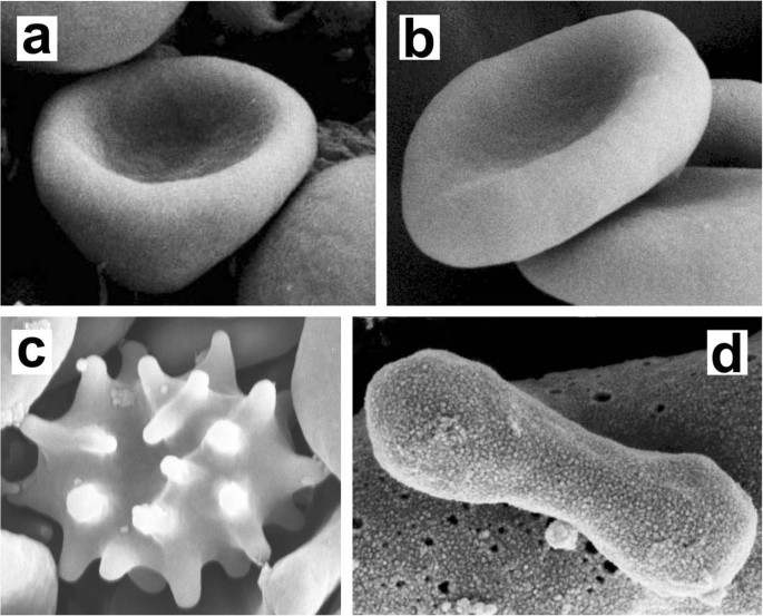 Normal red blood cells' shape stabilized by membrane's in-plane ordering |  Scientific Reports