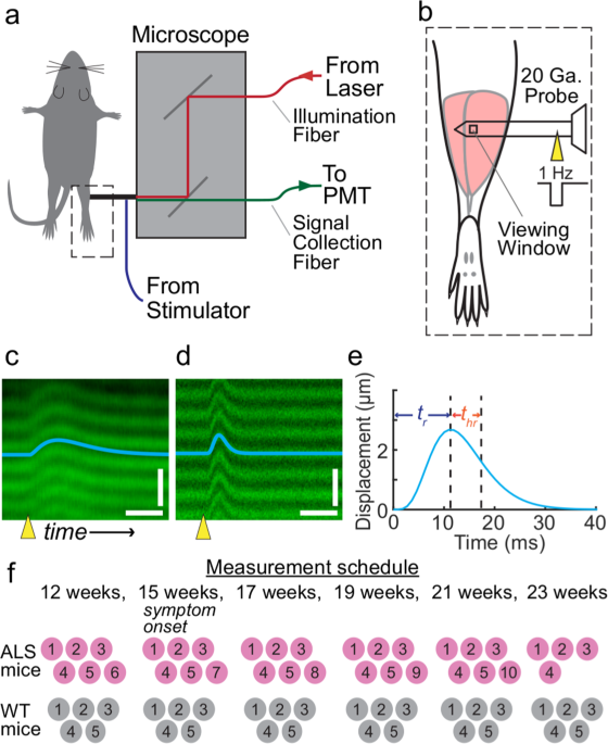 Microendoscopy detects altered muscular contractile dynamics in a mouse  model of amyotrophic lateral sclerosis | Scientific Reports
