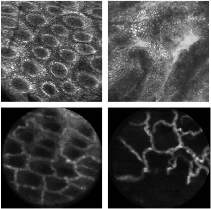 Machine Learning Based Classification Of The Health State Of Mice Colon In Cancer Study From Confocal Laser Endomicroscopy Scientific Reports Machine Learning Based Classification Of The Health State Of Mice Colon In Cancer Study From Confocal Laser Endomicroscopy Scientific Reports