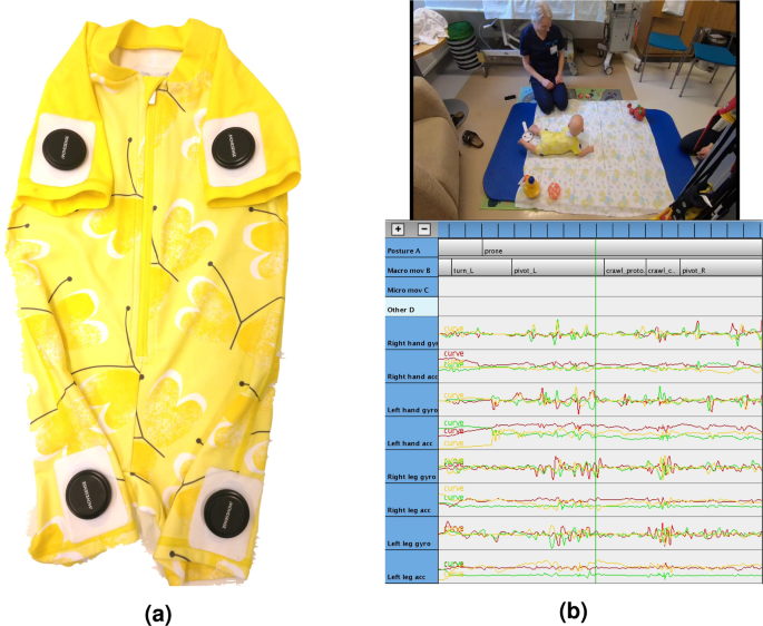 Automatic Posture And Movement Tracking Of Infants With Wearable Movement Sensors Scientific Reports