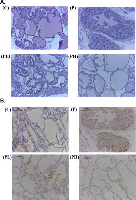 Mangos Pericarp Components Alleviate Progression Of Prostatic Mangos Pericarp Components