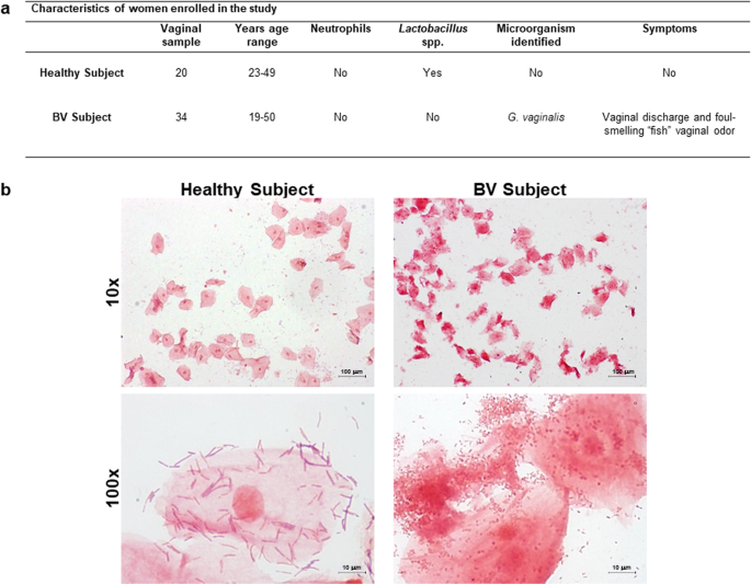 Unveiling the 6 Vaginal Discharge Types: A Complete Breakdown