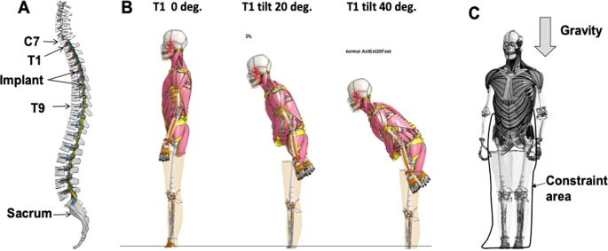 Anatomical Teaching Models, Plastic Vertebrae Model