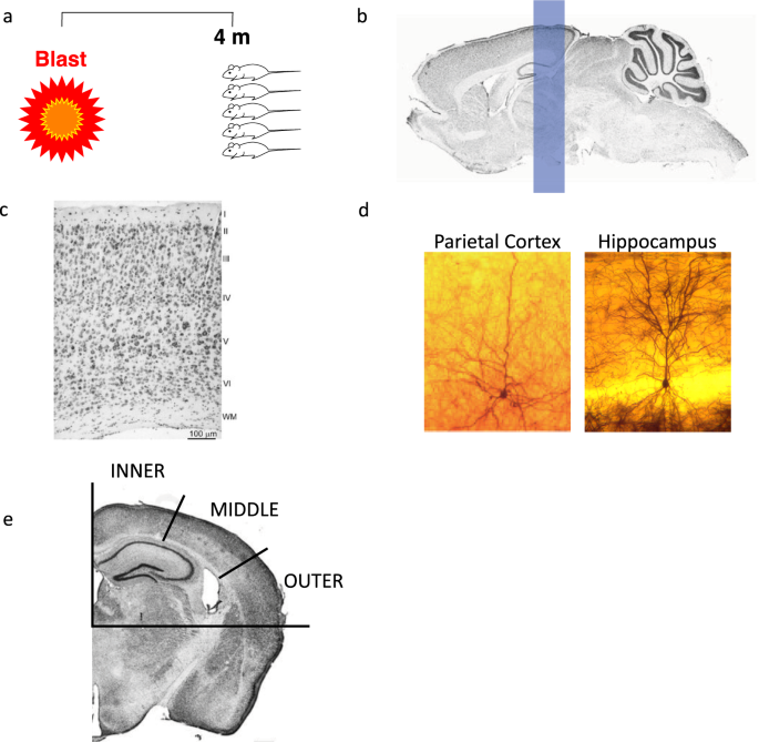 What Have We Learned About Blast Injury Since the Days of “Shell