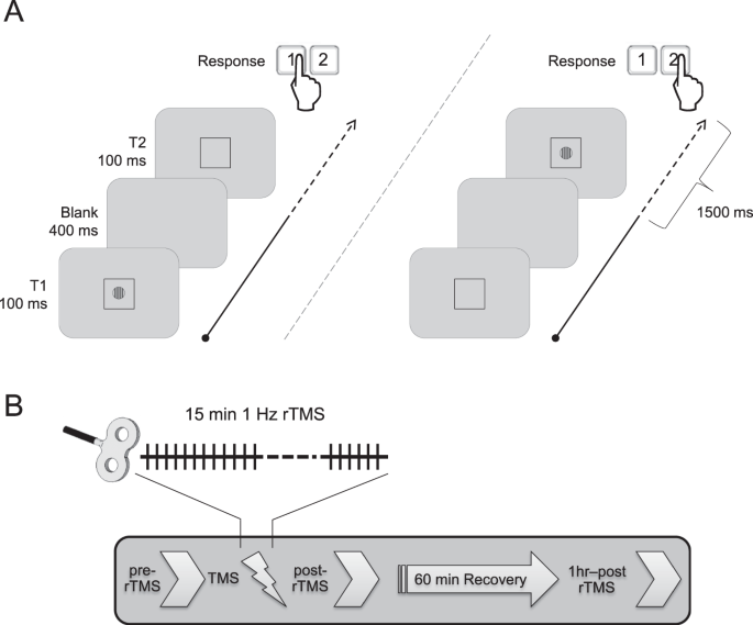 Low frequency transcranial magnetic stimulation of right posterior parietal cortex reduces reaction time to perithreshold low spatial frequency visual