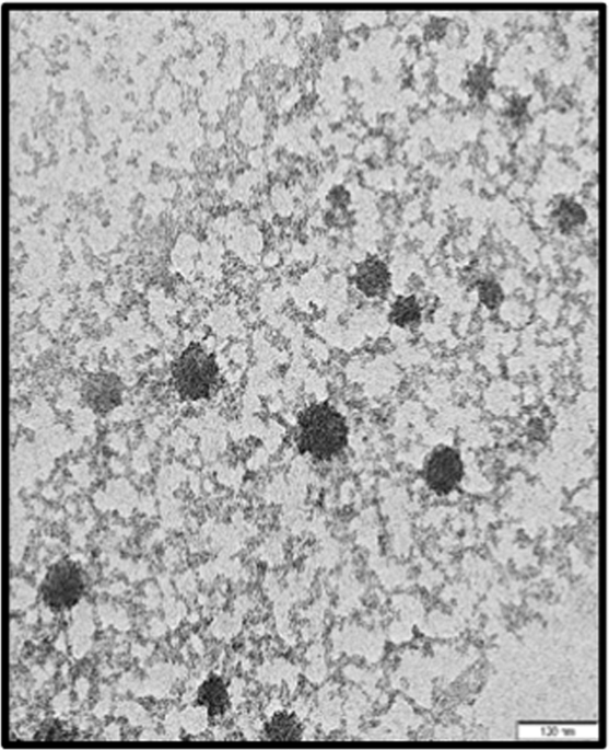 Homalomena pineodora essential oil nanoparticle inhibits diabetic 