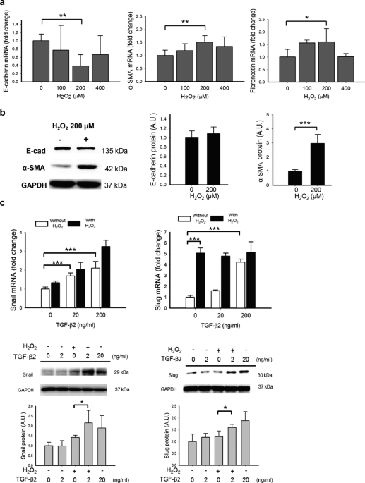 Oxidative Stress Enhanced The Transforming Growth Factor B2 Induced Epithelial Mesenchymal Transition Through Chemokine Ligand 1 On Arpe 19 Cell Scientific Reports